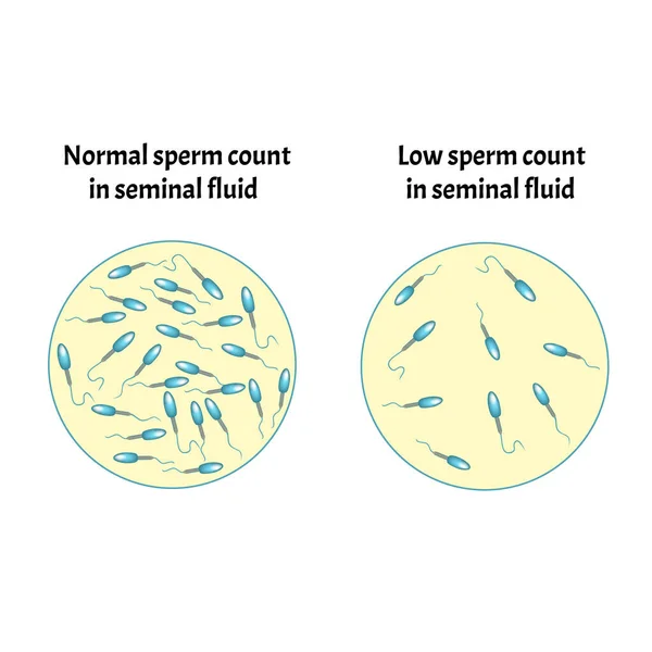 Yalangoch senator Padme Amidala