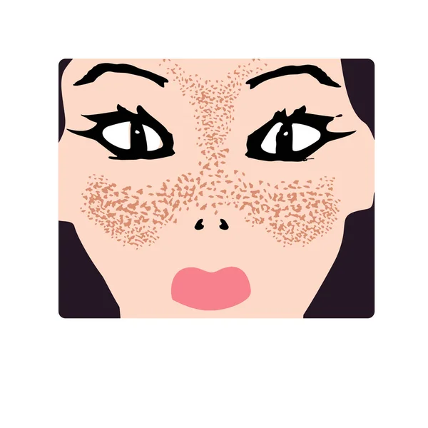 Taches de rousseur sur le visage. Pigmentation sur la peau. Tache pigmentée sur la peau du visage. Illustration vectorielle — Image vectorielle