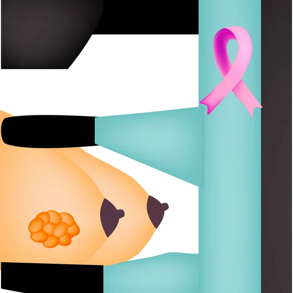 Всемирный день борьбы с раком груди. Розовая лента против рака груди. маммография, маммография, диагноз. Векторная иллюстрация на изолированном фоне . — стоковый вектор