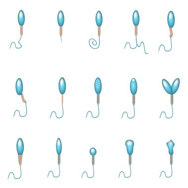 Boşalan spermin patolojik formları. Erkek kısırlığı Oligospermia. Spermogram. Sperm patolojisi tipleri. Sperm kusurları. Bilgi grafikleri. İzole edilmiş arkaplanda vektör illüstrasyonu.