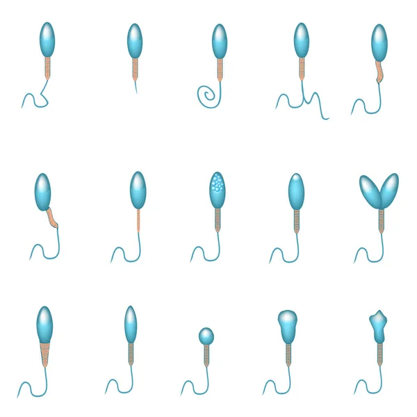 Patologické formy spermií v ejakulátu. Mužská neplodnost Oligospermie. Spermogram. Typy spermií. Vady spermií. Infographics. Vektorová ilustrace na izolovaném pozadí. — Stockový vektor