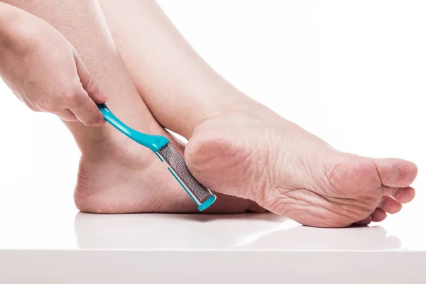 Dehydrierte Füße mit Pediküre Bimsstein — Stockfoto