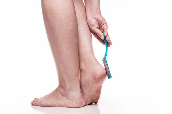 Обезвоженные ноги с педикюрной пемзой — стоковое фото