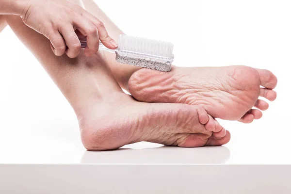 Dehydrated feet with pedicure pumice — Stock Photo, Image
