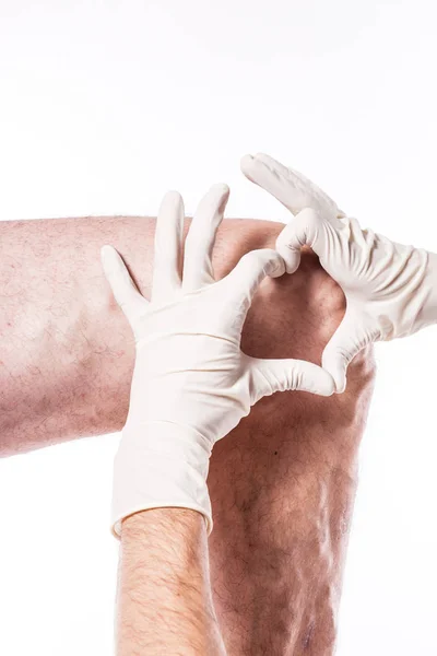 Doctor examines leg with blocked veins — Stock Photo, Image