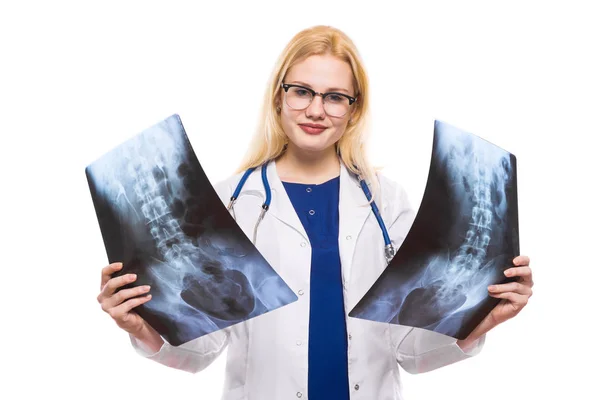 Junge Ärztin Mit Zwei Röntgenaufnahmen Isoliert Auf Weißem Hintergrund — Stockfoto