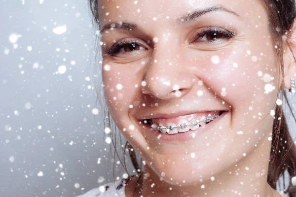 Retrato de mulher jovem com aparelho dental natural — Fotografia de Stock