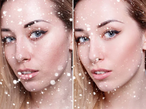 Przed i po operacji kosmetycznych. Młoda ładna kobieta portret — Zdjęcie stockowe