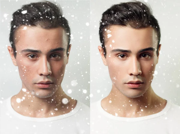 Antes e depois da operação cosmética. Jovem bonito homem retrato — Fotografia de Stock