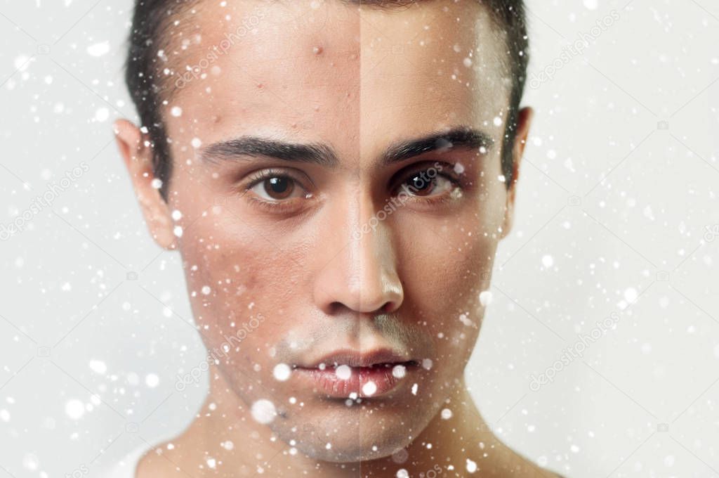 Before and after cosmetic operation. Young pretty man portrait