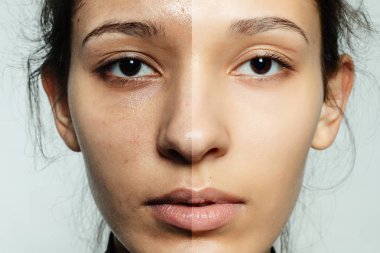 Önce ve sonra kozmetik işlemi.