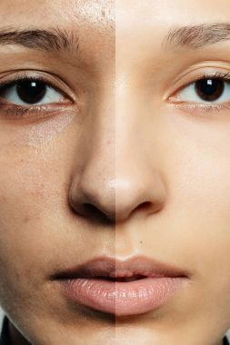 Önce ve sonra kozmetik işlemi.