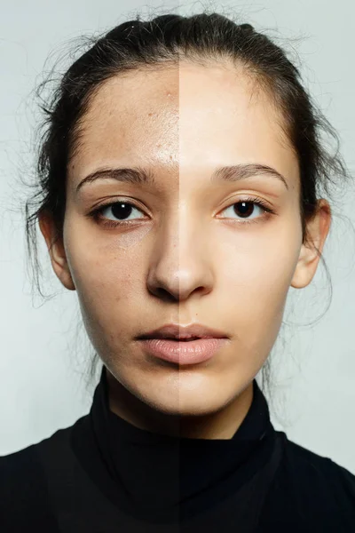 Antes e depois da operação cosmética . — Fotografia de Stock