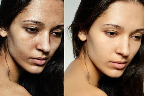 Prima e dopo l'operazione cosmetica . — Foto Stock