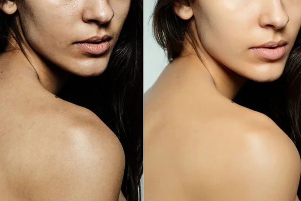 Before and after cosmetic operation. — Stock Photo, Image