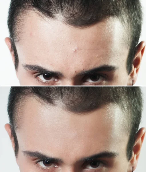 Önce ve sonra kozmetik işlemi. Genç adam portresi — Stok fotoğraf