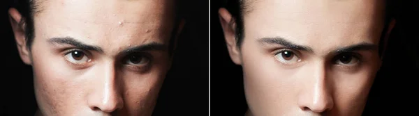 Před a po kosmetické operaci. Portrét mladého muže — Stock fotografie