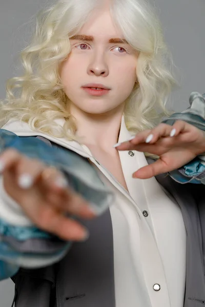 Bela Menina Albino Com Pele Branca Lábios Naturais Cabelos Encaracolados — Fotografia de Stock