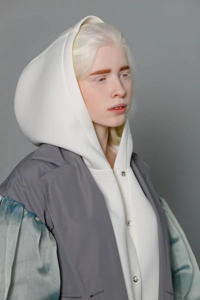 Красивая Девушка Альбинос Белой Кожей Натуральными Губами Белыми Кудрявыми Волосами — стоковое фото