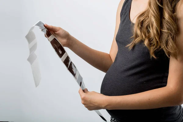 Jonge zwangere vrouw — Stockfoto