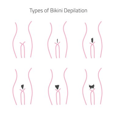 Types of bikijni hair removal in flat linear style. Can be used for infographics, banners clipart