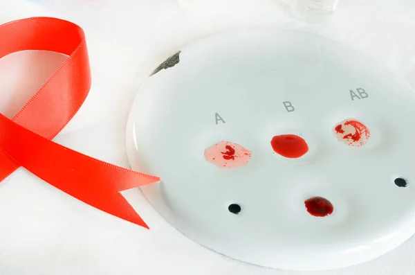 Kan örnekleme ve hafif bir arka plan üzerinde bir biyokimyasal laboratuvar analizi. Kırık bir kenarı ile bir tabak. — Stok fotoğraf