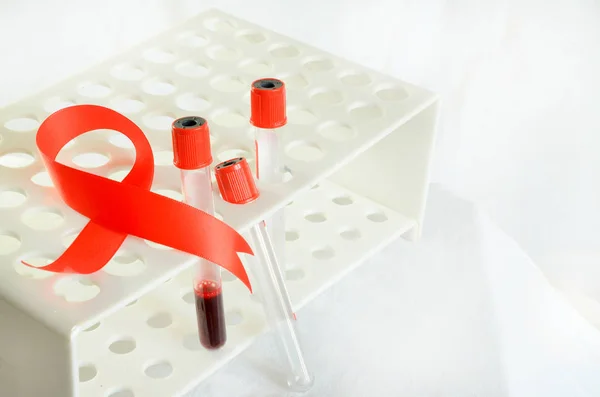 Kan örnekleme ve hafif bir arka plan üzerinde bir biyokimyasal laboratuvar analizi.