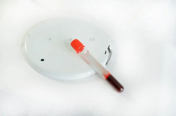 Kan örnekleme ve hafif bir arka plan üzerinde bir biyokimyasal laboratuvar analizi. Kırık bir kenarı ile bir tabak. — Stok fotoğraf
