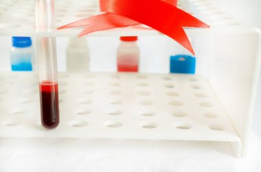 Kan örnekleme ve hafif bir arka plan üzerinde bir biyokimyasal laboratuvar analizi.