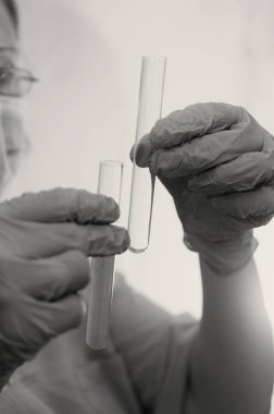 Doktor biyolojik bir sıvı ile testleri yapar.