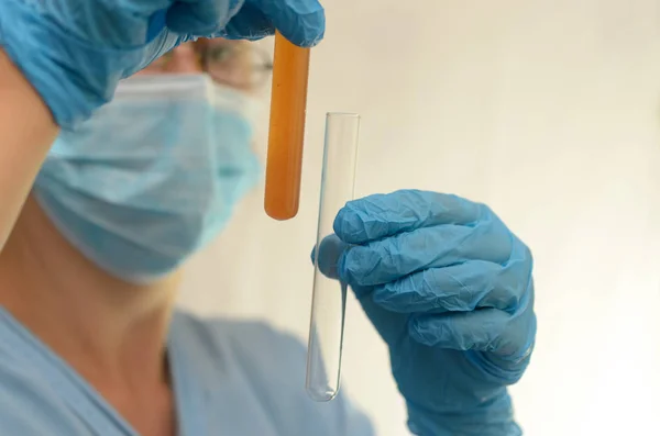 Doktor biyolojik bir sıvı ile testleri yapar.