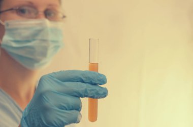 Doktor biyolojik bir sıvı ile testleri yapar.