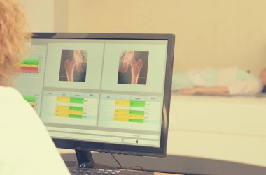 Bir kadın x-ray Dansitometresi sonuçlarını inceler.