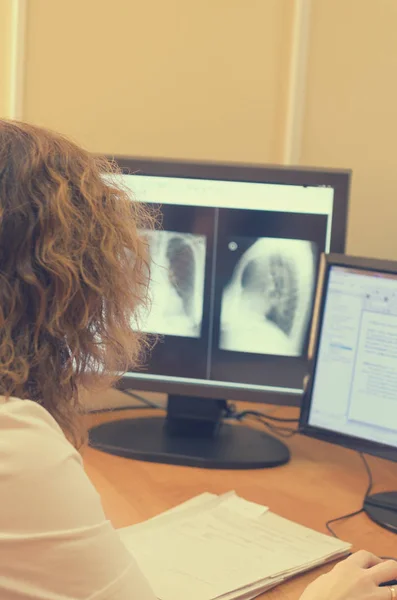O radiologista olha para as imagens de raios-x em um monitor de computador . — Fotografia de Stock