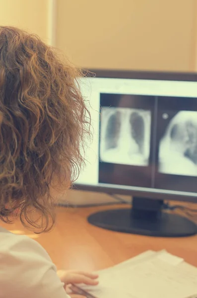O radiologista olha para as imagens de raios-x em um monitor de computador . — Fotografia de Stock