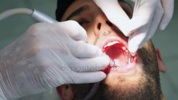 Dentista curando a un paciente masculino — Vídeo de stock