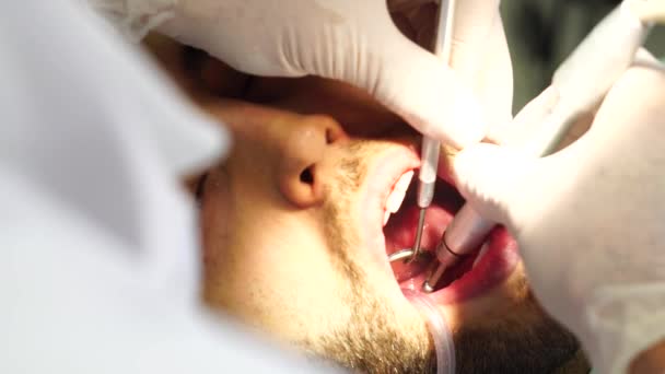 Dentista cura un paziente maschio — Video Stock