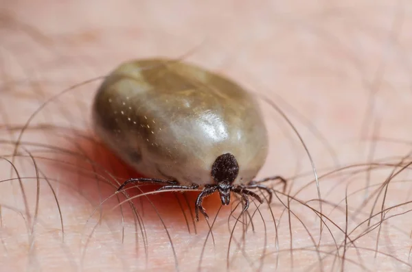 Kene kan insan derisi üzerinde oturma dolu