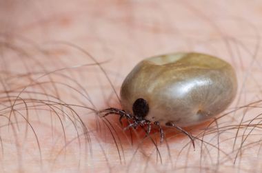 Kene kan insan derisi üzerinde oturma dolu