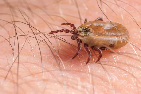 Mite crawls on human skin — Stock Photo, Image