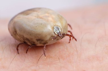 Kene kan insan derisi üzerinde oturma dolu