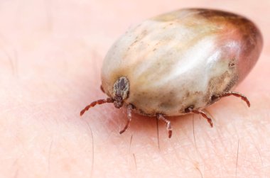 Kene kan insan derisi üzerinde oturma dolu