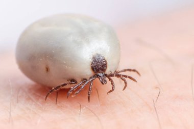 Kene kan insan derisi üzerinde oturma dolu