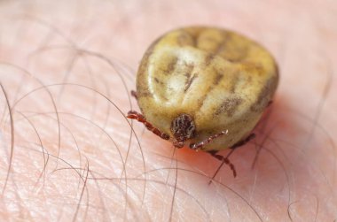 Kene kan insan derisi üzerinde oturma dolu