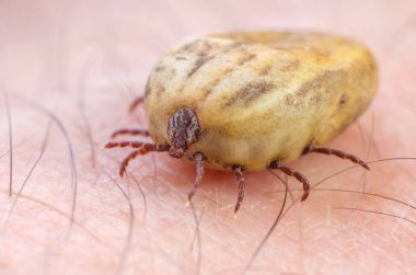 Kene kan insan derisi üzerinde oturma dolu