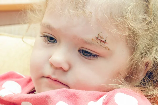 眉の上に傷のある少女深い傷が縫われた — ストック写真