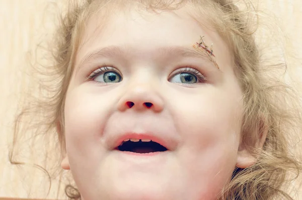 Kaşının üstünde yara izi olan küçük bir kız, dikilmiş derin bir yara. — Stok fotoğraf
