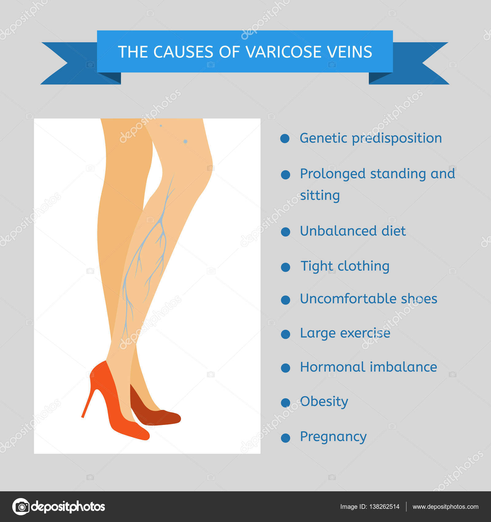 List 101 Wallpaper Pictures Of Varicose Veins On The Legs Superb 102023