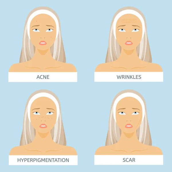 피부 문제: hyperpigmentation, 여드름, 주름, 흉터 — 스톡 벡터