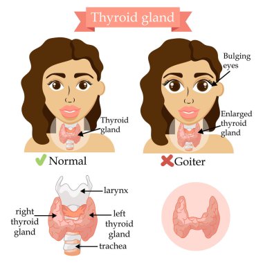 Tiroid bezi. Tıbbi kavramı. İnsan anatomisi. Vektör çizim. Kadın ile sağlık banner. 